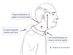 Archlifter™ - The Ultimate Neck Traction Device